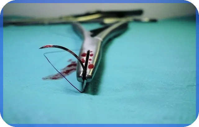 청년 전세대출조건 이해하기 2025